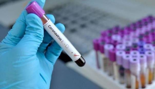 U BiH 285 novozaraženih, pet osoba umrlo