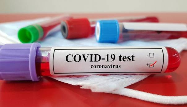 U BiH 286 novozaraženih koronom, 9 osoba umrlo