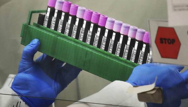 U BiH 310 novooboljelih od koronavirusa, dvije osobe umrle