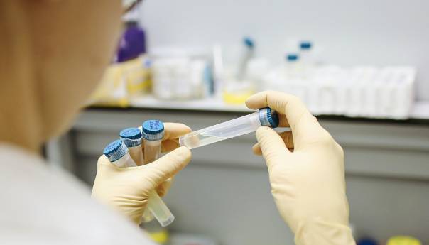 U BiH 402 novozaraženih koronavirusom