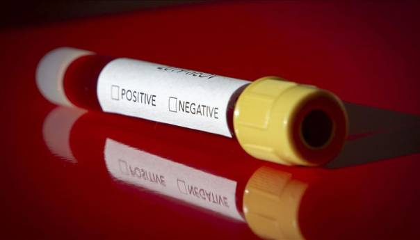 U BiH od virusa korona dosad se oporavilo 19.507 osoba