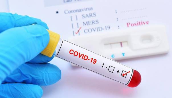 U BiH registrovana nova 172 slučaja koronavirusa