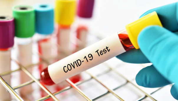 U Bihaću dva, u Cazinu jedan novi slučaj koronavirusa