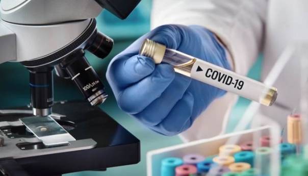 U Brazilu ukupno 695.427 oboljelih od Covida-19