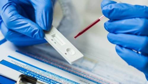 U Britaniji će svima biti dostupni brzi Covid testovi