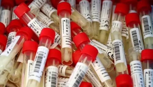 U Crnoj Gori 187 novih slučajeva, slijedi kontrola poštovanja mjera