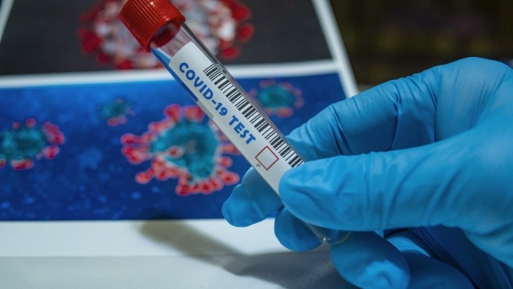U Crnoj Gori 531 novi slučaj koronavirusa, deset osoba umrlo