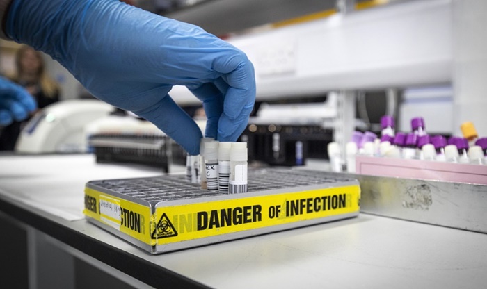 U Crnoj Gori 70 zaraženih virusom covid-19