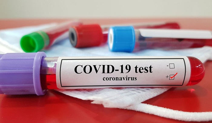 U Crnoj Gori 91 novi slučaj zaraze, četiri osobe preminule