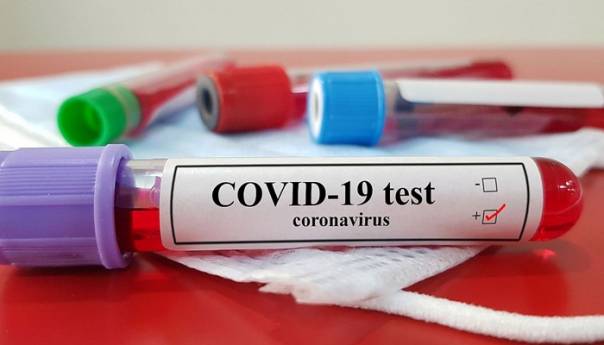 U Crnoj Gori 91 novi slučaj zaraze, četiri osobe preminule