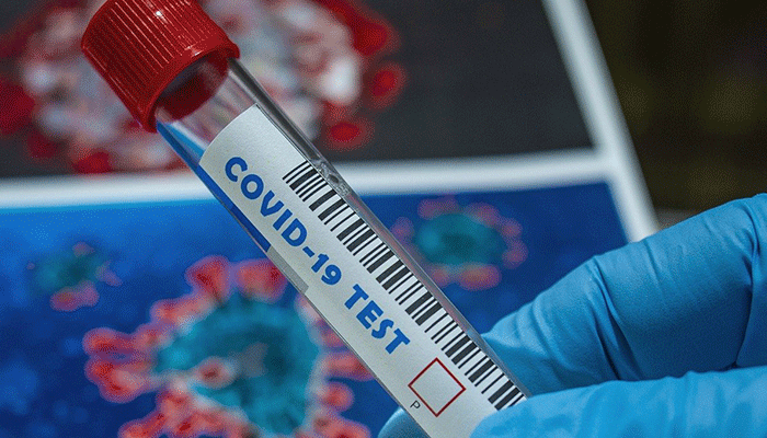 U Crnoj Gori još 378 zaraženih, preminula jedna osoba