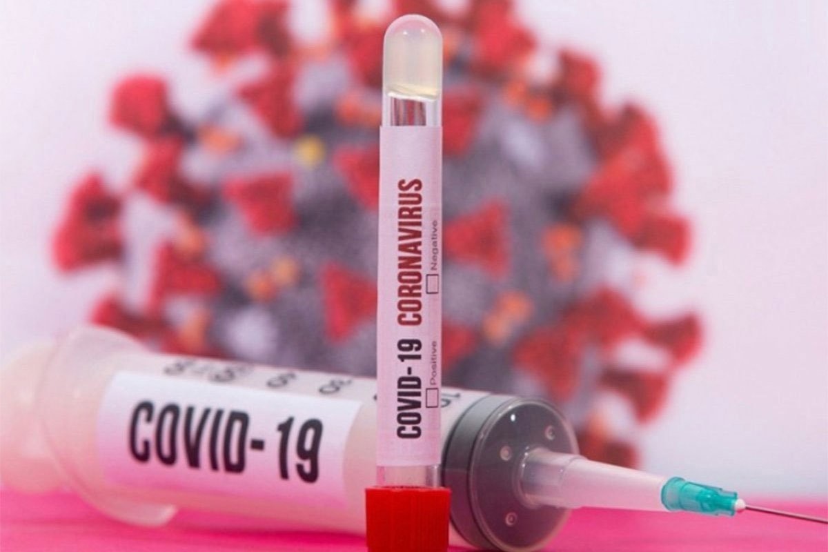 U Crnoj Gori još 86 zaraženih, jedna osoba preminula