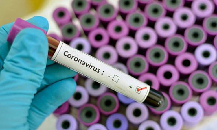U Crnoj Gori još 96 zaraženo koronavirusom, tri osobe preminule