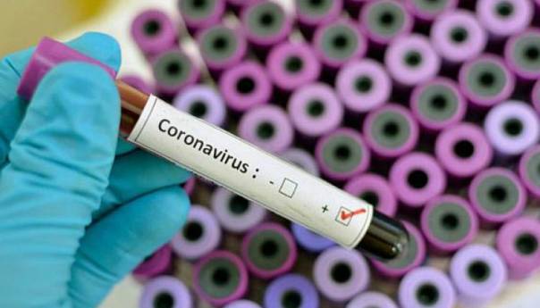 U Crnoj Gori još 96 zaraženo koronavirusom, tri osobe preminule
