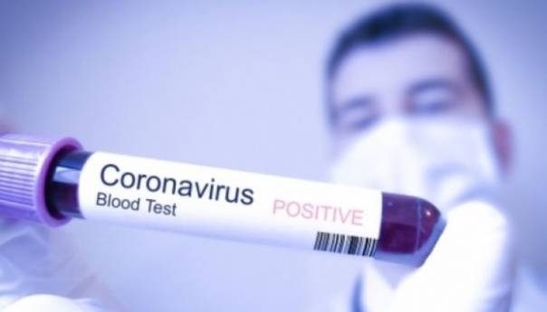 U Crnoj Gori nema novozaraženih koronavirusom