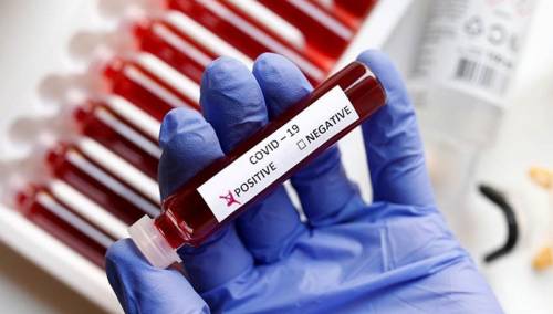 U Crnoj Gori novih 17 slučajeva koronavirusa