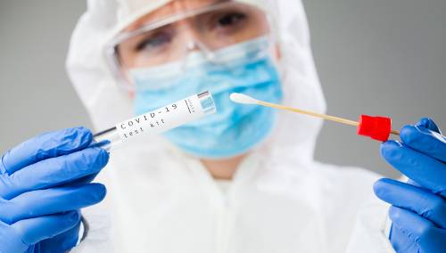 U Crnoj Gori novozaraženih 471, bez preminulih