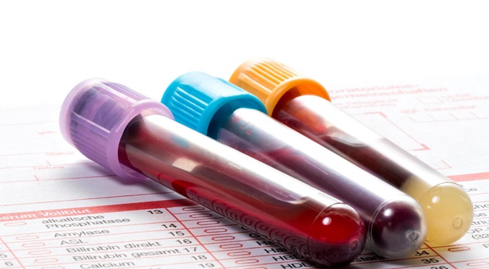 U Crnoj Gori testirano 45 uzoraka, tri pozitivna na virus korona
