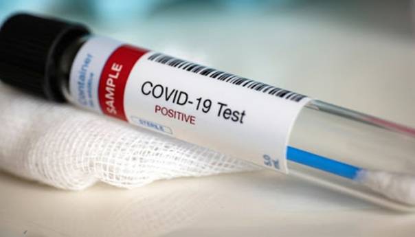 U FBiH 174 novozaraženih i 11 umrlih od korone