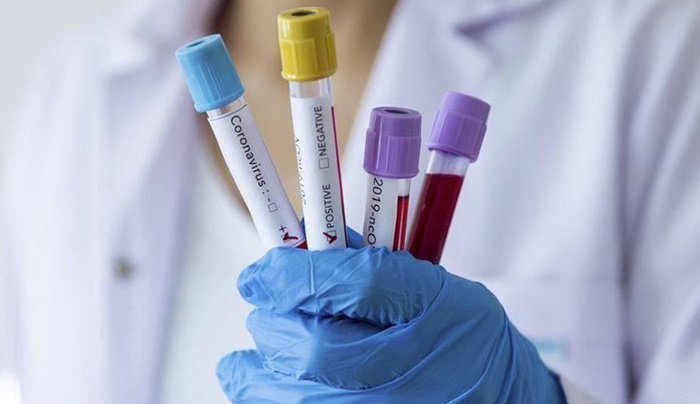 U FBiH 18 novooboljelih od koronavirusa i jedan smrtni slučaj