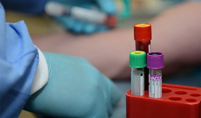 U Federaciji BiH 178 novozaraženih i četiri smrtna slučaja