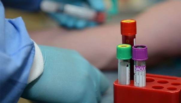 U Federaciji BiH 178 novozaraženih i četiri smrtna slučaja