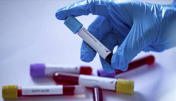 U Federaciji BiH još 139 zaraženih koronavirusom