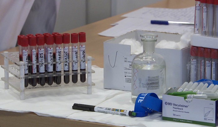 U Federaciji BiH testirano 789 uzoraka, 110 pozitivno na COVID-19
