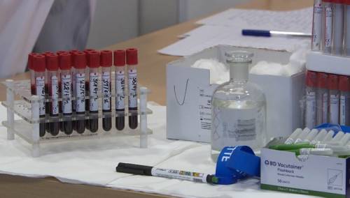 U Federaciji BiH testirano 789 uzoraka, 110 pozitivno na COVID-19