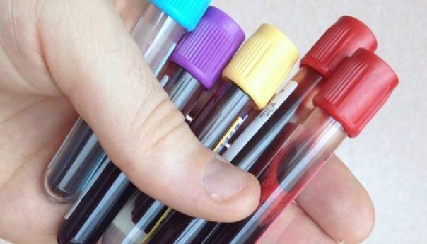 U Federaciji još 143 zaražena koronavirusom