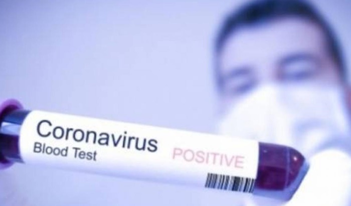 U Holandiji potvrđen prvi smrtni slučaj zbog koronavirusa