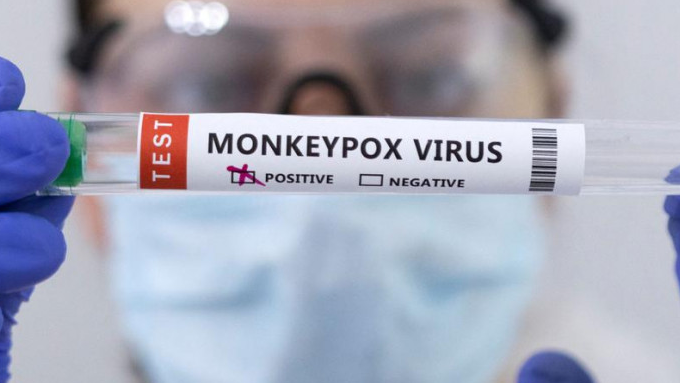 U Hrvatskoj 10 slučajeva majmunskih boginja, očekuje se dolazak vakcina