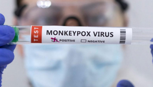 U Hrvatskoj 10 slučajeva majmunskih boginja, očekuje se dolazak vakcina