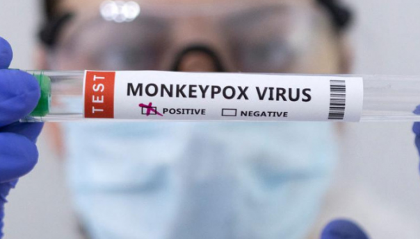 U Hrvatskoj 10 slučajeva majmunskih boginja, očekuje se dolazak vakcina