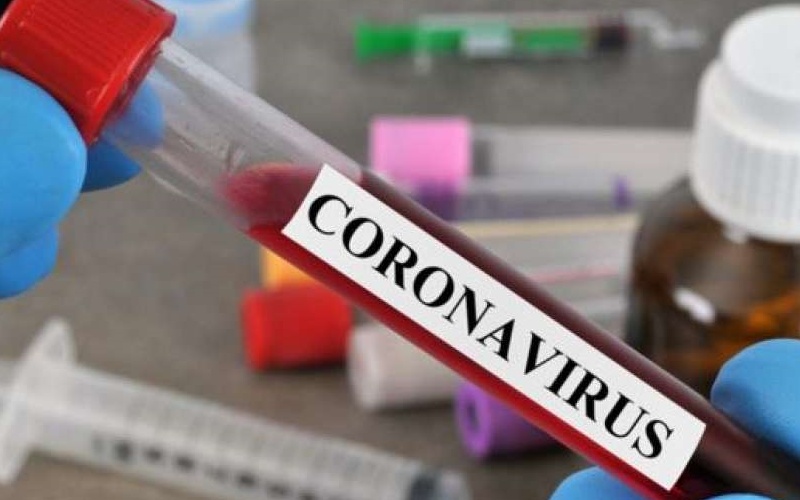 U Hrvatskoj 728 novih slučajeva zaraze koronavirusom, preminulo 11 osoba
