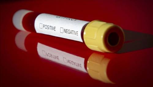 U Hrvatskoj nema novih slučajeva zaraze korona virusom