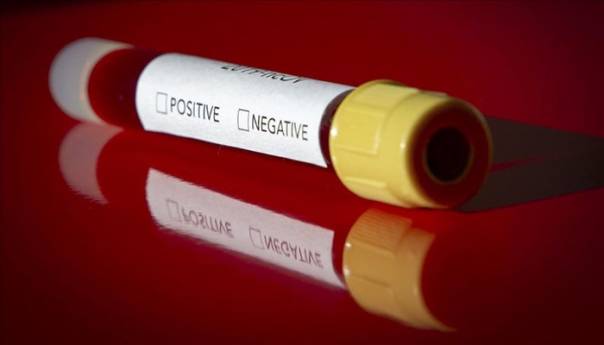 U Hrvatskoj nema novih slučajeva zaraze korona virusom