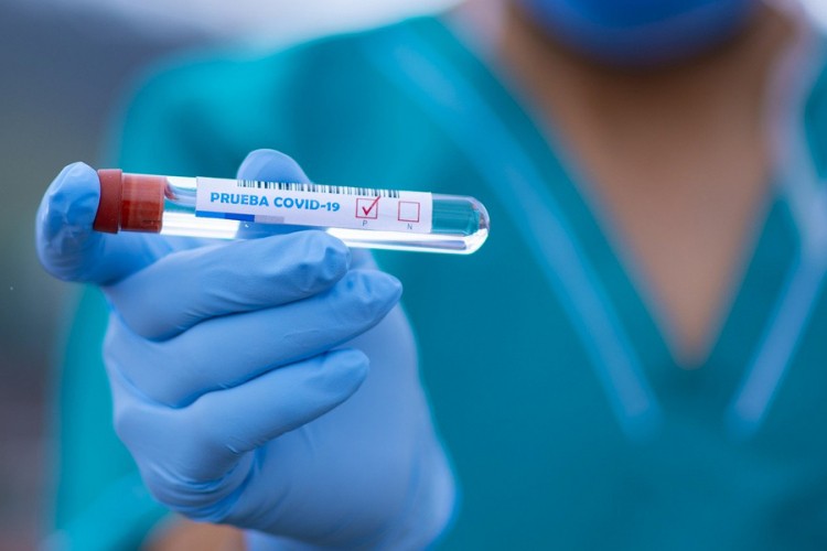 U Hrvatskoj novih 19 slučajeva zaraze
