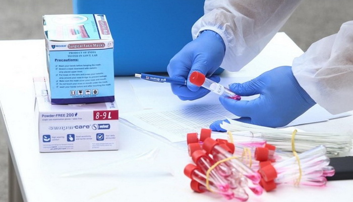 U Hrvatskoj znatno niže cijene testiranja na Covid-19