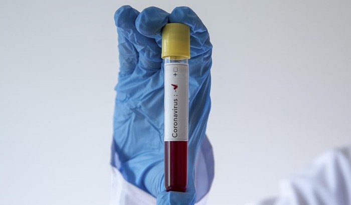 U Kambodži prvi smrtni slučaj od koronavirusa godinu dana od izbijanja pandemije