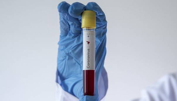 U Kambodži prvi smrtni slučaj od koronavirusa godinu dana od izbijanja pandemije