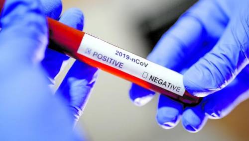 U Kantonu Sarajevo potvrđeno 135 novozaraženih