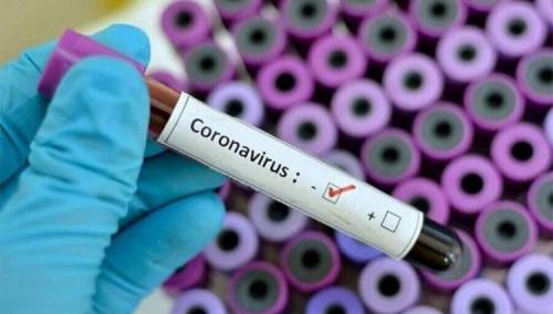 KCUS: Testirano 327 uzoraka, osam novozaraženih, najviše iz KS