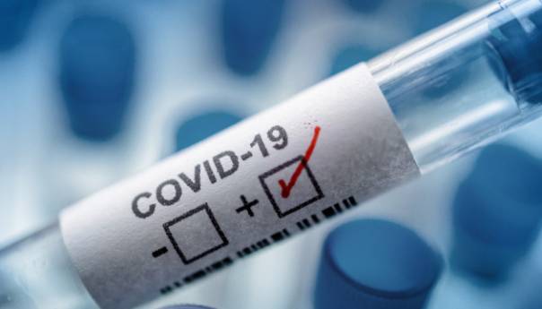 U KS 1.374 novozaražena koronavirusom