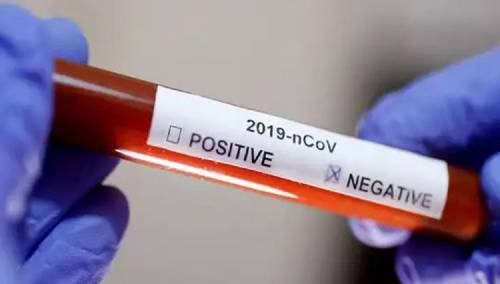 U KS 16 novozaraženih i 18 oporavljenih