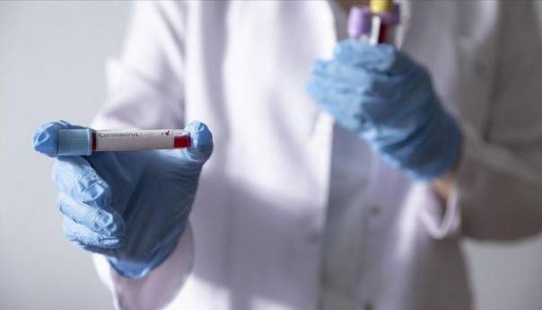 U KS 31 novi slučaj zaraze koronavirusom