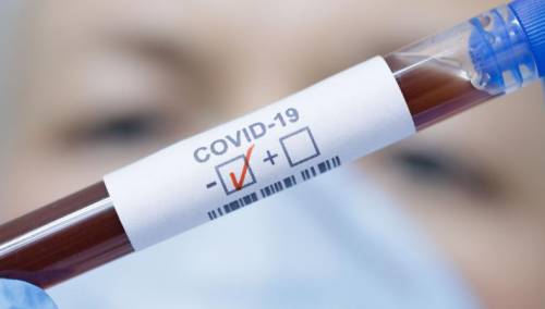 U KS 36 novozaraženih, 28 oporavljenih