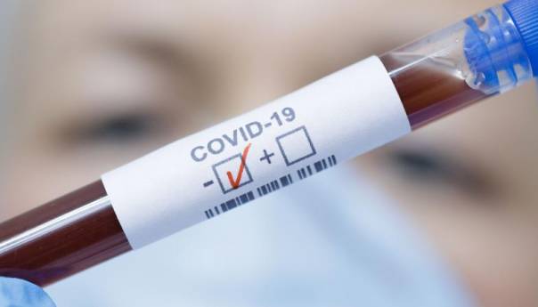 U KS 36 novozaraženih, 28 oporavljenih