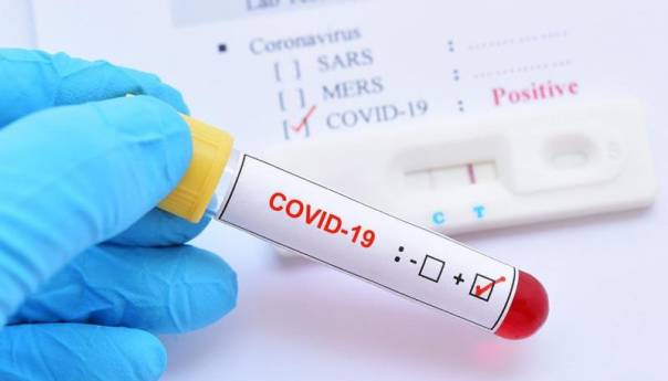 U KS 367 novozaraženih koronavirusom