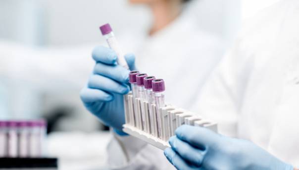 U KS 40 novozaraženih, 87 oporavljenih